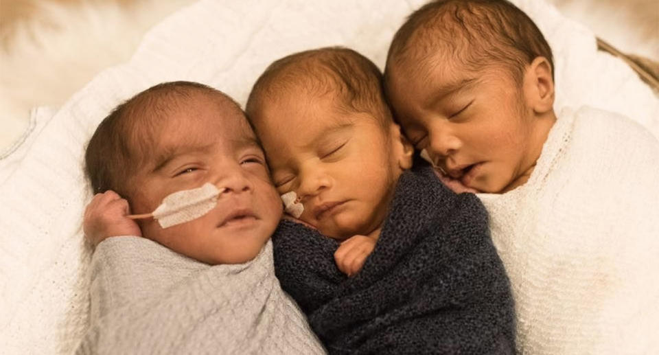 The triplets were born on August 31 2017, a week before their due date. Source: GoFundMe