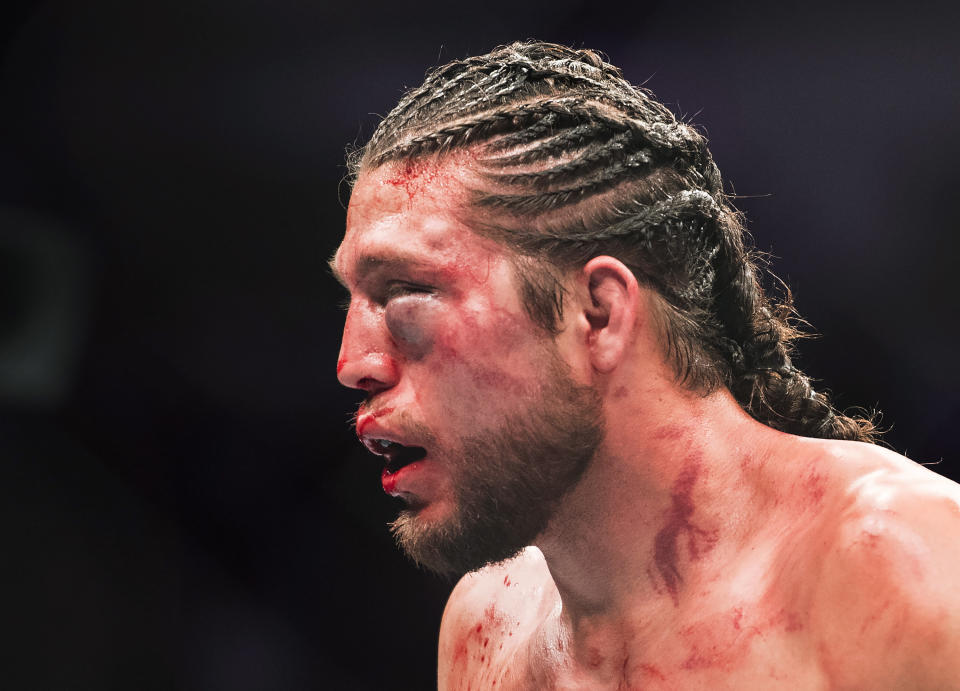 Brian Ortega leaves the octagon after being knocked out by Max Holloway during the featherweight championship mixed martial arts bout at UFC 231 in Toronto on Saturday, Dec. 8, 2018. (Nathan Denette/The Canadian Press via AP)