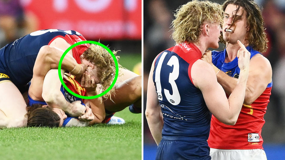 Highlighted left is Jarrod Berry appearing to touch the eyes of Clayton Oliver, with Oliver remonstrating on the right.