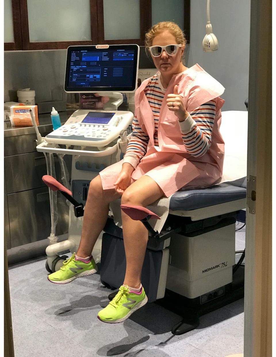 Comedian Amy Schumer gives a thumbs up at a doctor's appointment.