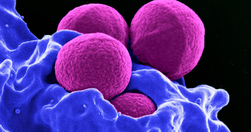 若感染「超級細菌MRSA」，嚴重者可能引起敗血症。（圖／達志／路透社）