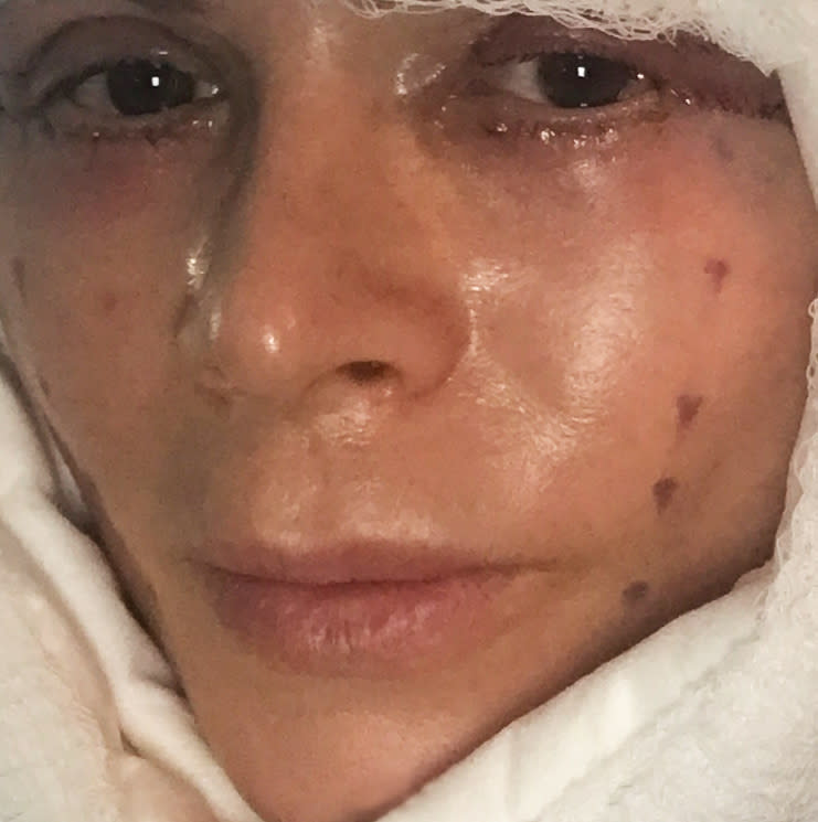 The reality star debuted her new cosmetic surgery on Andy Cohen's talk show