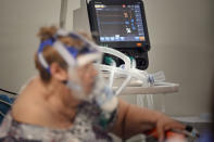 A patient breathes through an oxygen mask in a COVID-19 isolation room at the University Emergency Hospital in Bucharest, Romania, Friday, Oct. 22, 2021. In Romania, a European Union country of around 19 million, only 35% of adults are fully inoculated against COVID-19 compared to an EU average of 74%.(AP Photo/Vadim Ghirda)