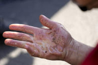 FILE - A climate activist with the group Uprising of the Last Generation looks at his hand after it was carefully loosened by police from the ground it was glued to in Berlin, Germany, March 18, 2022. The group claims the world has only a few years left to turn the wheel around and avoid catastrophic levels of global warming. (AP Photo/Markus Schreiber, File)