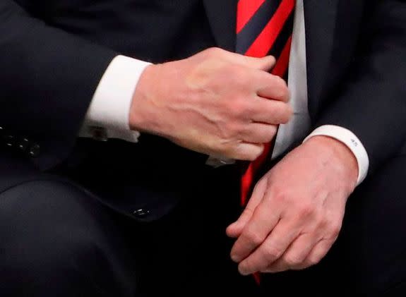 President Trump's hand.
