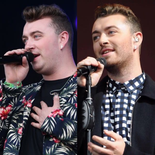 It's safe to say Sam Smith has kept the weight off and then some. The 23-year-old British singer was in Miami recently, but his painful looking sunburn wasn't the only thing that had jaws dropping -- this is the skinniest we've ever seen the "Lay Me Down" singer since he started losing weight earlier this year. "My sun burn is SO BAD �������� Lobster viiiiiiiibes �� Just had to make this top to give it some air hahhaaaaa Lord," he wrote. <strong>WATCH: Sam Smith Admits Someone Calling Him Fat Hurts Him More Than Anti-Gay Slurs</strong> Check out how handsome Smith's looking these days! Even the GRAMMY award winner himself is impressed with the incredible weight loss he's achieved in the last year alone. Smith has credited Amelia Freer, a nutritional therapist and author of <em>Eat. Nourish. Glow.: 10 Easy Steps for Losing Weight, Looking Younger & Feeling Healthier</em>, for his incredible results. "2014 - 2015 -- a lot has changed haha," he acknowledged last week with these before and after photos. Perhaps Smith is extra motivated these days to stay on the fitness track, given his new collaboration with Balenciaga on their upcoming Fall/Winter 2015 campaign, which he just announced last week. <strong>WATCH: Sam Smith Responds to Howard Stern Calling Him Fat & Ugly</strong> In April, Smith candidly admitted that someone calling him fat actually affects him more than anti-gay slurs. "If someone called me fat, that affects me way more than someone calling me a f----t," he admitted to Australia's <em>60 Minutes</em>. "I think just because I've accepted that, if someone calls me a f----t, it's like, I am gay and I'm proud to be gay so there's no issues there. If something calls you fat, that's something I want to change." Watch below: