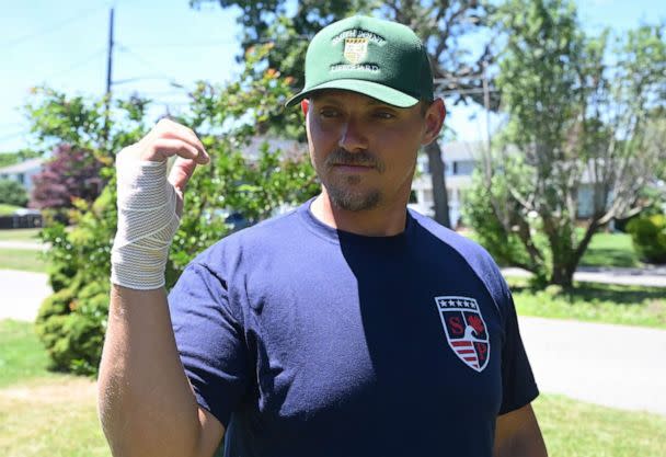 PHOTO: Bayport, N.Y.: Lifeguard Zachari Gallo shows his wounded arm outside his home, July 4, 2022, after he was bitten by a shark during a training exercise at Smith Point County Park in Shirley, New York the day before. (James Carbone/Newsday via Getty Images)