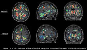 Baseline versus 3-month PET scans