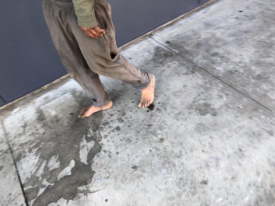 homeless crisis in Venice Beach