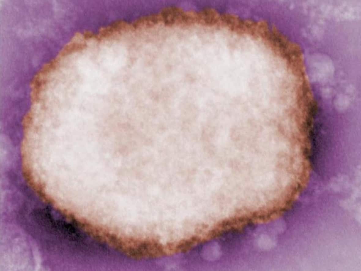 A negative stain electron micrograph shows a mulberry-type monkeypox virus particle. Toronto health officials announced Saturday that they are investigating the city's first suspected case of monkeypox. (CDC - image credit)