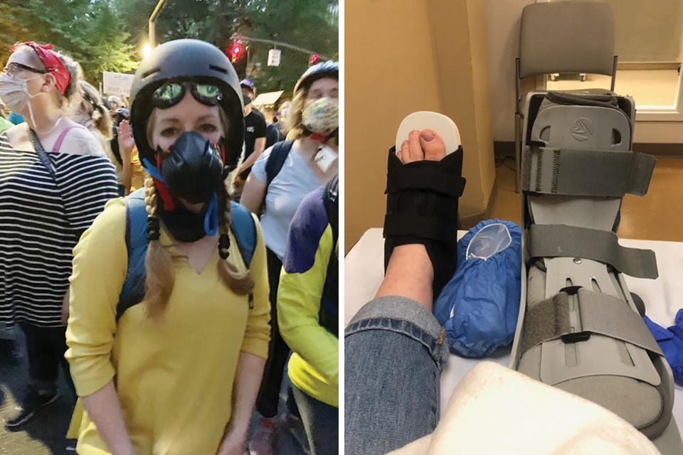 Ellen Urbani was hit in the foot by what she believes was a rubber bullet at a protest in Portland, Ore., on July 24.<span class="copyright">Courtesy Joan Henderson-Gaither/Ellen Urbani (2)</span>