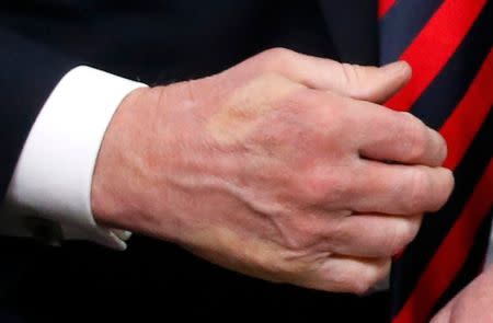 The imprint of French President Emmanuel Macron's thumb can be seen across the back of U.S. President Donald Trump's hand after they shook hands during a bilateral meeting at the G7 Summit in Charlevoix, Quebec, Canada, June 8, 2018. REUTERS/Leah Millis