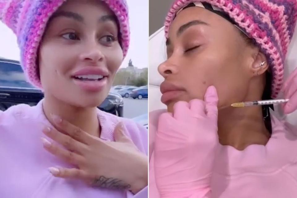 https://www.instagram.com/p/Cp1KEMLjgHX/.  Blac Chyna reveals results of having her facial fillers dissolved after 'Looking Like Jigsaw'.  Black Chyna/Instagram