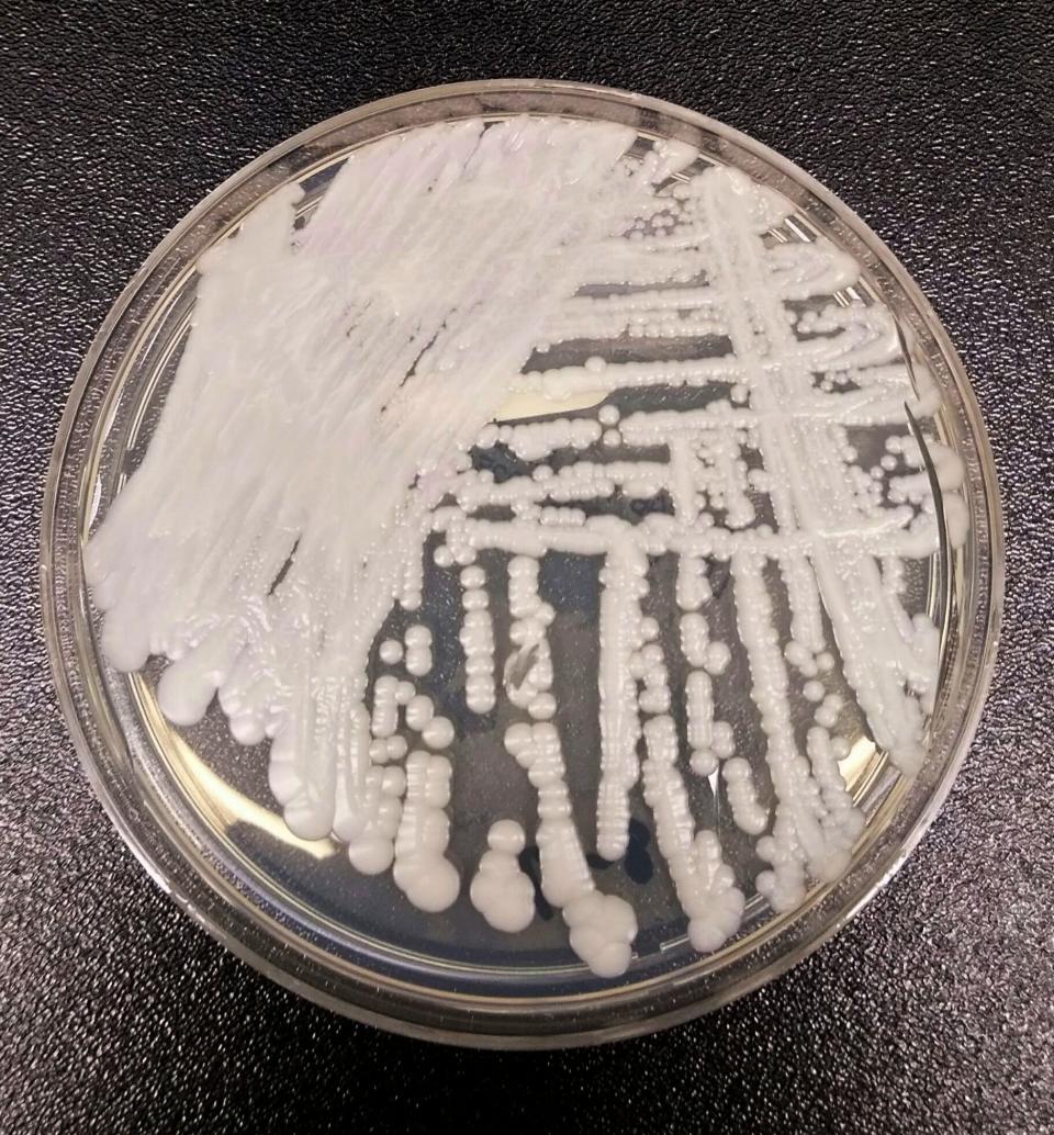 A strain of Candida auris, a deadly "superbug" fungus