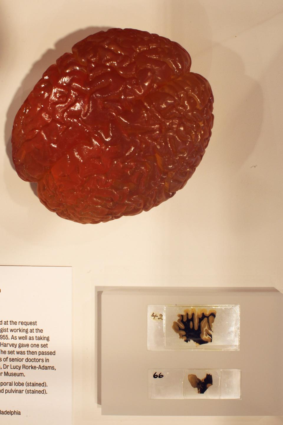 The Wellcome Collections Unveils Their New Exhibition Brains