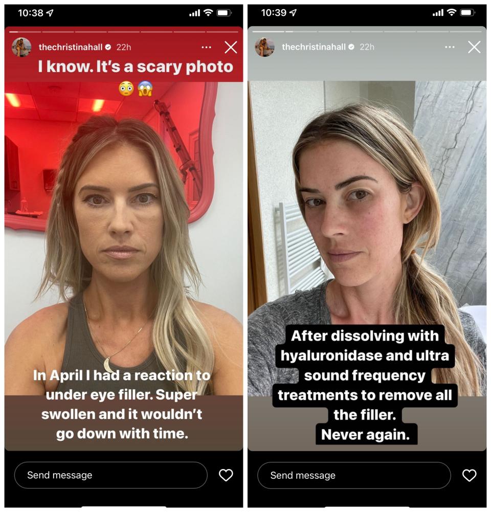 Christina Hall Instagram Stories Health Updates