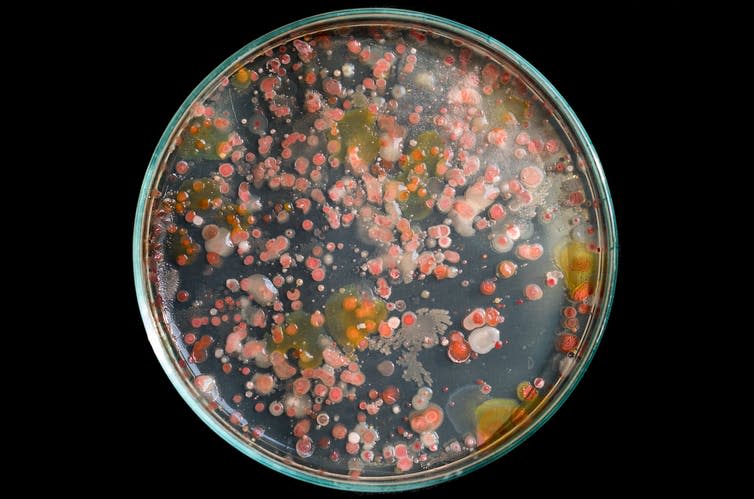 A petri dish with pink and orange bacteria growing on nutrient agar.