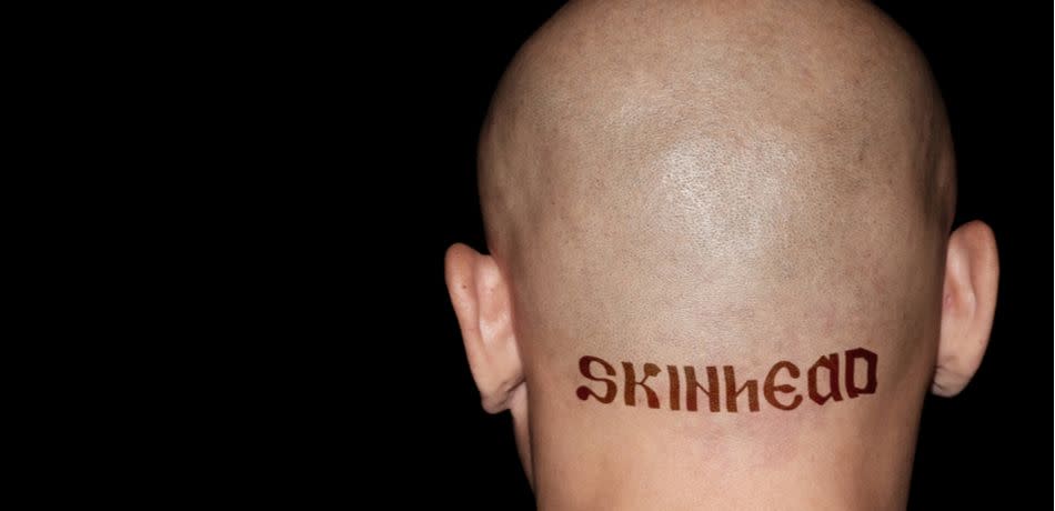 Skinhead