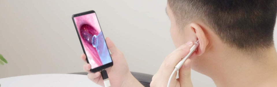 Turn your smartphone into an Otoscope-Ear Scope. (Photo: Amazon)