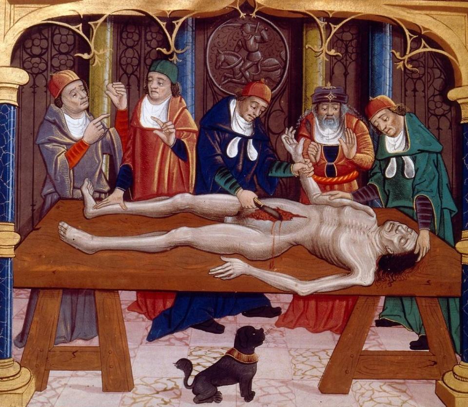 Ilustración medieval de una autopsia realizada en la edad media. Del manuscrito francés "Las propiedades de las cosas" de Bartholomaeus Anglicus, finales del siglo XV.