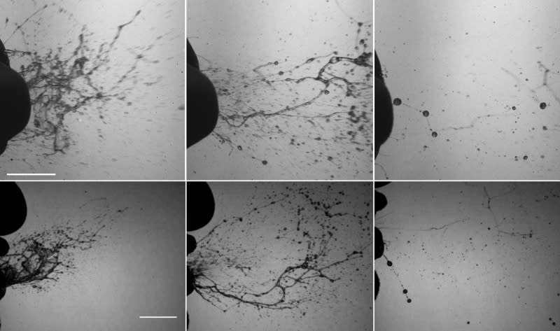 Top and side views of the rapid fragmentation process of mucosalivary fluid occurring during a healthy sneeze. They reflect the sequence of formation of sheets and then filaments, ultimately leading to the formation of respiratory droplets outside of the mouth. These were captured with a camera operating at 6,000 to 8,000 frames per second.