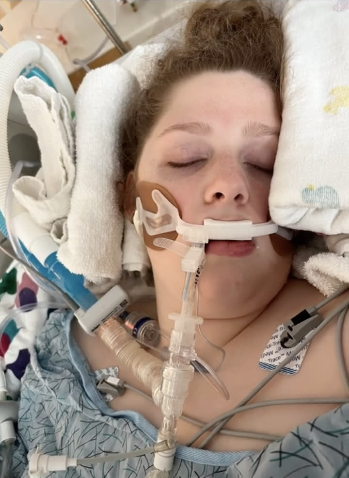 Avery was intubated after she had difficulty breathing. from inhaling bleach in an unventilated room. 