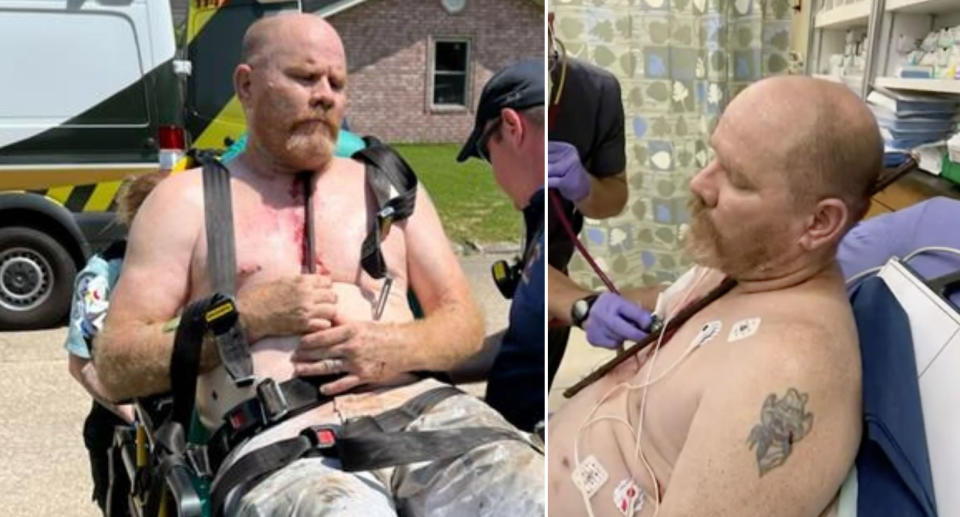 Michael Richard sits on a stretcher with the metal pole in his neck as he is wheeled towards an ambulance.