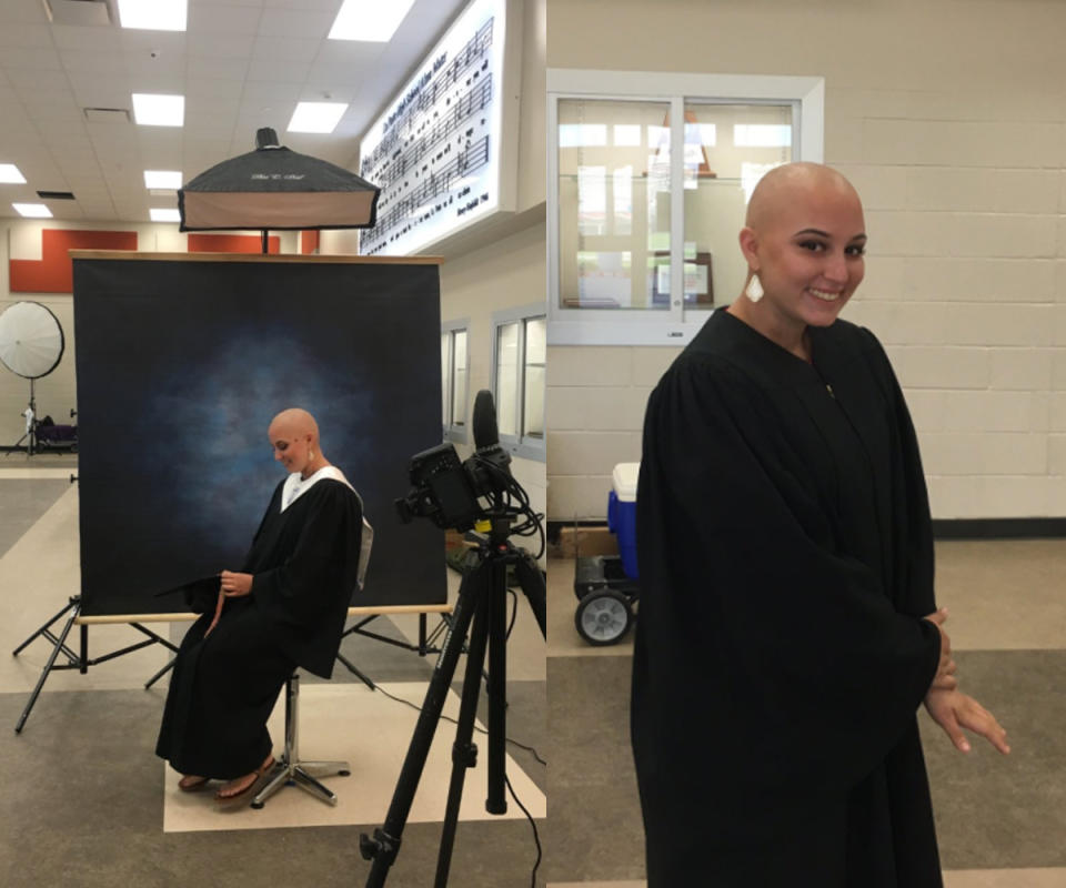 Morgan Carnish, who lost all her hair to cancer treatments, poses confidently for her high school senior portrait.
