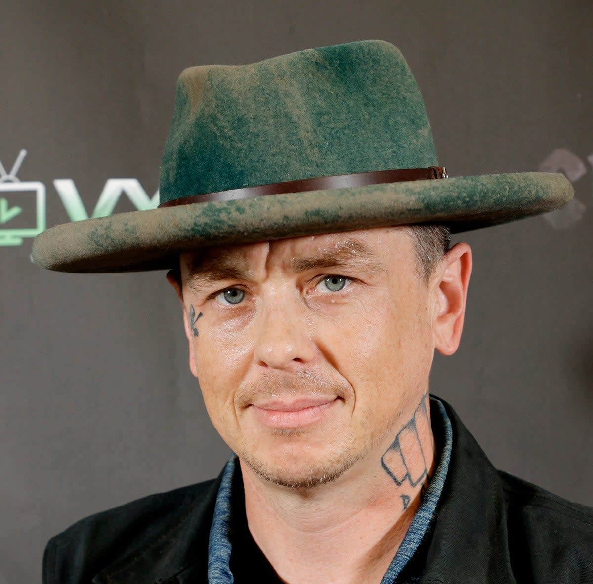 Sid Wilson said he’s lucky to be alive after sustaining serious burns in a bonfire explosion (Getty Images)