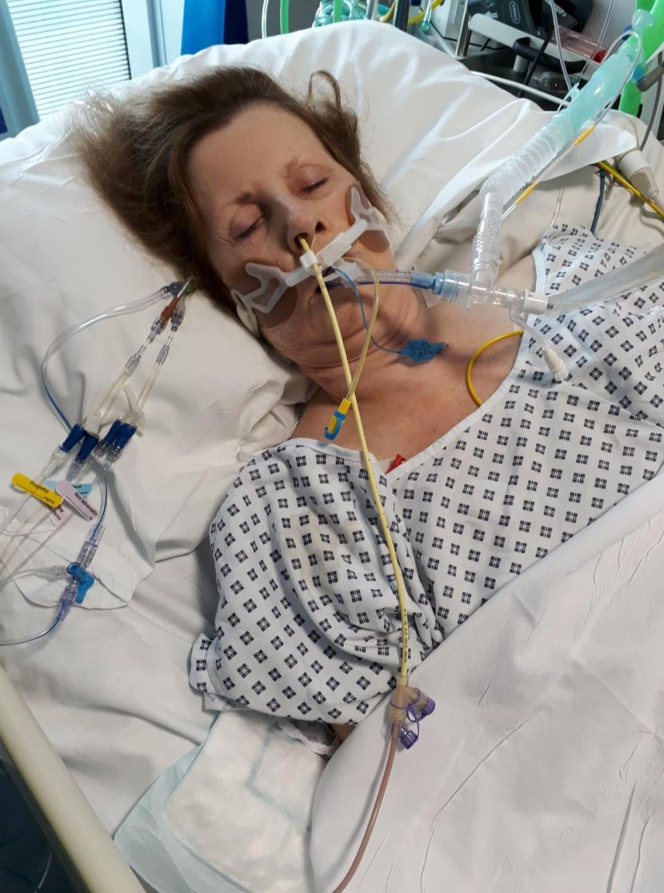 Shirley Hair was put in a medically-induced coma for five days to help her recover (Picture: SWNS)