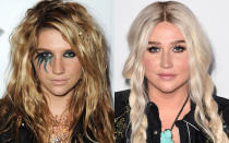 <p>Kesha is no stranger to having a little (or a lot of) fun with her makeup and hair looks, but there are many times when she’ll just go for a pair of killer lashes and prairie braids — an everyday look that many people can appreciate. (Photo: Getty Images) </p>