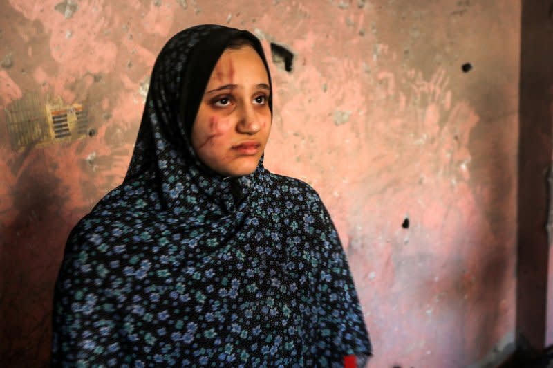 An injured Palestinian woman looks on in the aftermath of an Israeli strike in Rafah in southern Gaza Strip, Sunday, December. 24, 2023. UNRWA says it "cannot deliver meaningful aid" under intense Israeli bombardments of Gaza after the UN Security Council called for increased access. Photo by Ismael Mohamad/UPI