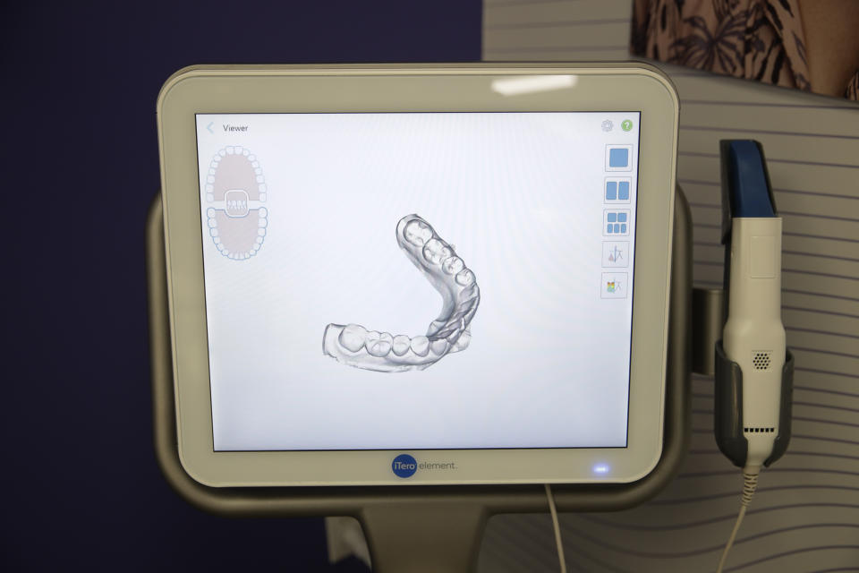 A scanned image of a patient's teeth is shown on a display of a 3-D scanner in SmileDirectClub's SmileShop located inside a CVS store Wednesday, April 24, 2019, in Downey, Calif. CVS Health is venturing into dental care with plans to offer the relatively new teeth-straightening service. (AP Photo/Jae C. Hong)