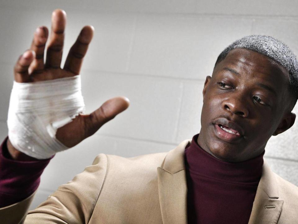 James Shaw Jr shows his hand that was injured when he disarmed a shooter inside a Waffle House (Wade Payne/The Tennessean via AP)