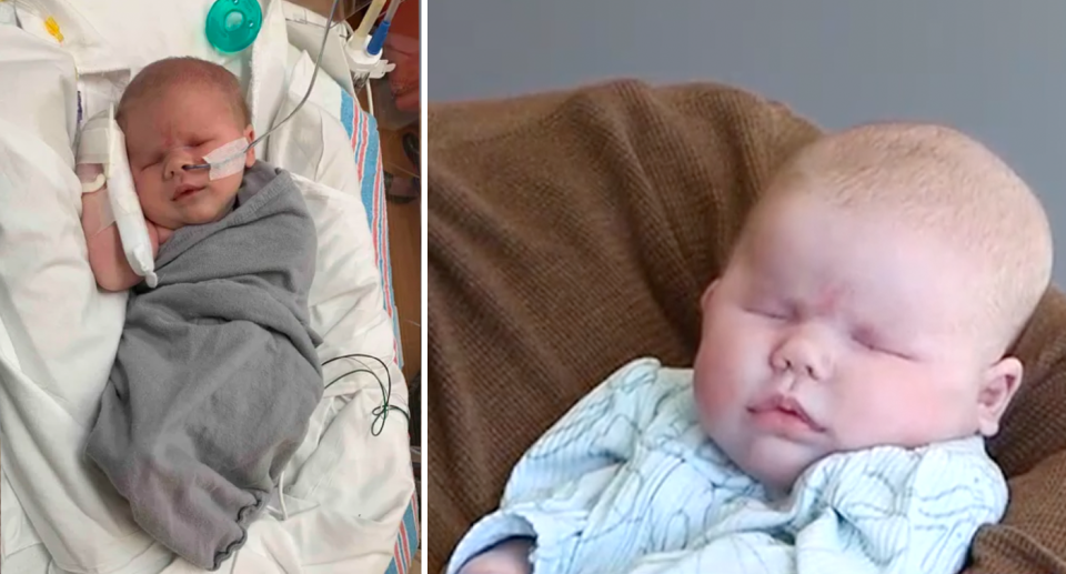 Left, Wrenley Ice lies in a hospital bed while connected to wires after being born without eyes. Right, she lies in her dad's arms. 