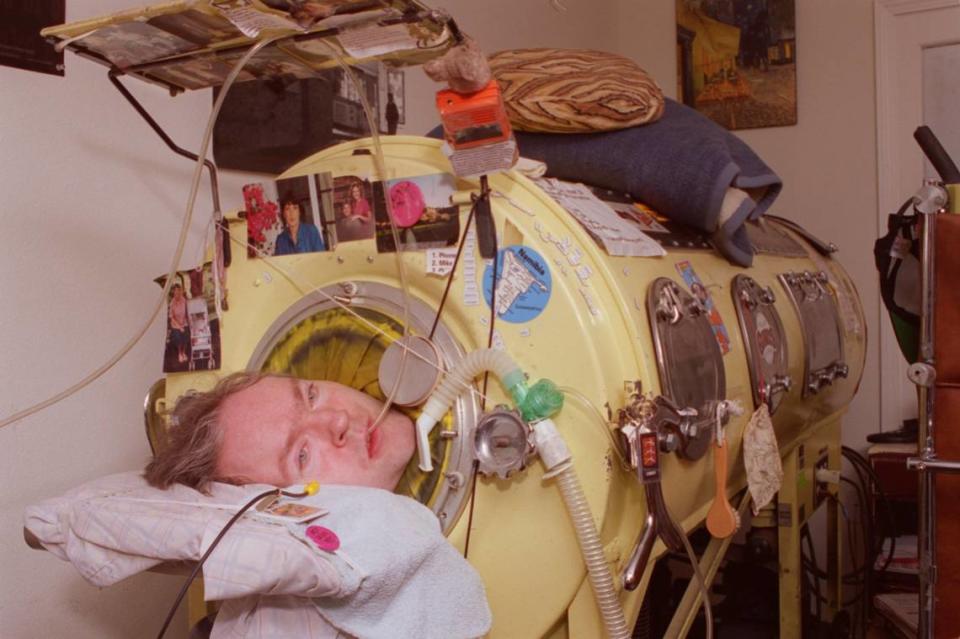 Mark O’Brien, a Berkeley poet, journalist and advocate for the disabled, breathes using an iron lung in March 1997. O’Brien, who contracted polio in childhood, died in 1999.