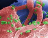 Il nuovo sottotipo è stato trovato in tre campioni, due analizzati nel 1983 e al 1990, e uno che era stato raccolto nel 2001 ma che non aveva una quantità sufficiente di virus per essere trovato con le tecniche dell'epoca. (Centers for Disease Control and Prevention/via REUTERS).