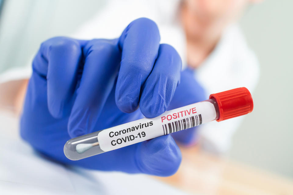 Coronavirus Infected Swab Test Sample in Doctor Hands. COVID-19 Epidemic and Virus Outbreak.