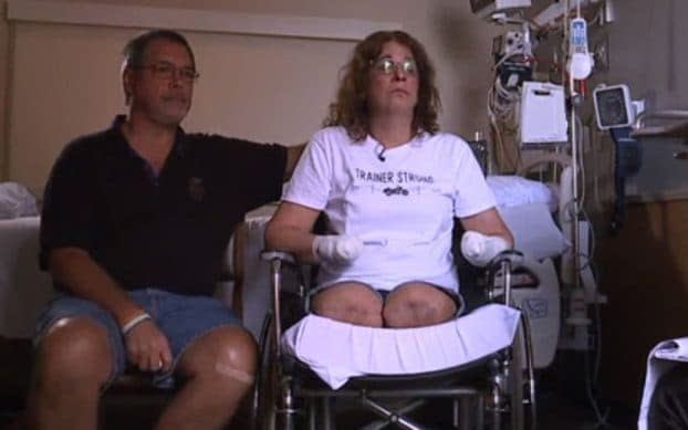 Marie Trainer woke from a coma to find her arms and legs had been amputated