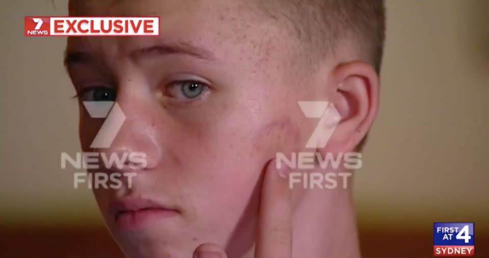 Deklan now needs tests to make sure he hasn't been infected with anything. Source: 7 News