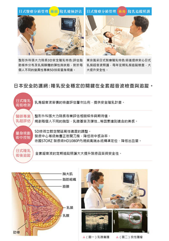 3D安全隆乳技術與超音波提升精準性 日式5D免按摩技術