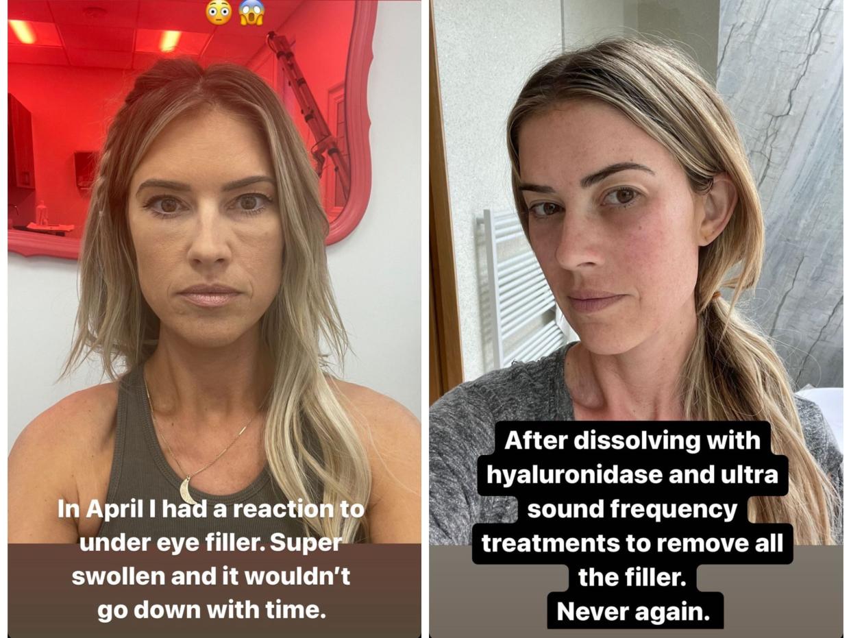 Christina Hall Instagram Stories Health Updates