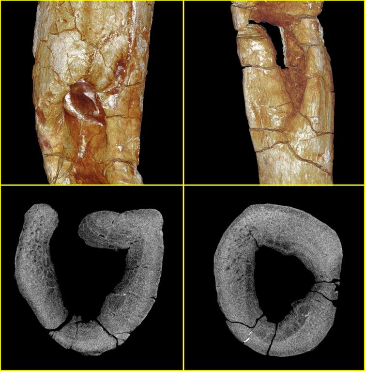 <span class="caption">Micro-computed tomography allowed us to produce surface renderings of the fossil in 3D (top row) and 2D X-ray slices through the rib (bottom row). These show areas of cellular reorganisation, bone destruction and bone formation indicative of ostemyelitis.</span> <span class="attribution"><span class="source">Patrick Randolph-Quinney, UCLan</span></span>