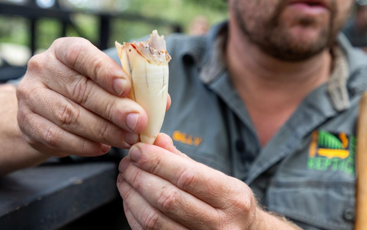 A zookeeper displays Elvis the crocodile's infected tooth after it was removed