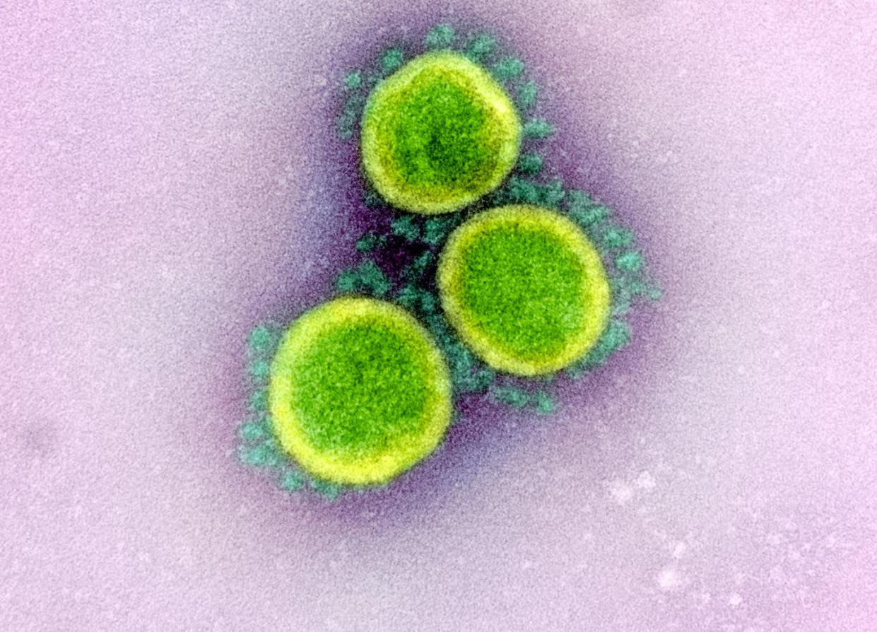 Coronavirus SARS-CoV-2. <a href="https://www.flickr.com/photos/niaid/49640655213/in/album-72157712914621487/" rel="nofollow noopener" target="_blank" data-ylk="slk:NIAID;elm:context_link;itc:0;sec:content-canvas" class="link ">NIAID</a>, <a href="http://creativecommons.org/licenses/by-sa/4.0/" rel="nofollow noopener" target="_blank" data-ylk="slk:CC BY-SA;elm:context_link;itc:0;sec:content-canvas" class="link ">CC BY-SA</a>