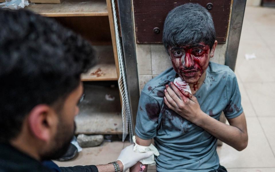 A Palestinian boy receives first aid at the Al-Aqsa Martyrs Hospital in central Gaza