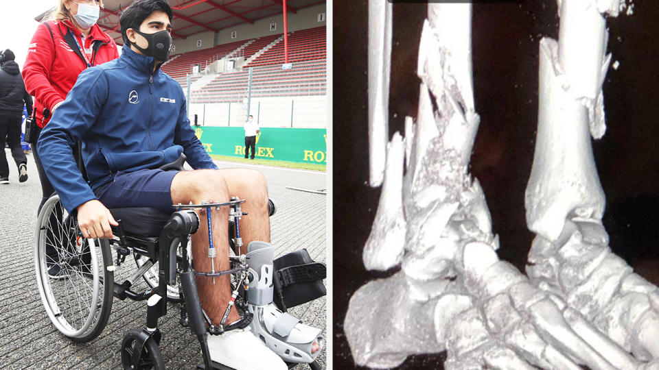 A 50-50 split image shows Juan Manuel Correa on the left in a wheelchair, and x-rays showing the damage to his legs on the right.