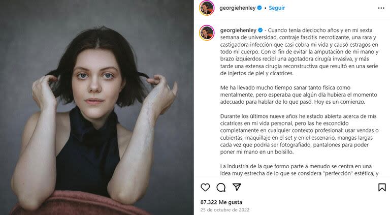 Geogie Henley abrió su corazón y contó detalles de la enfermedad que sufrió (Foto: captura Instagram/@georgiehenley)