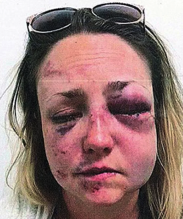 His victim was left with permanent damage to her eyes (Police handout)