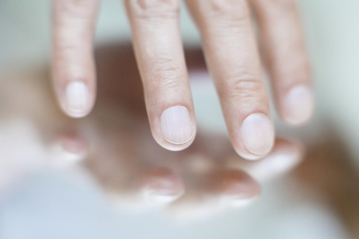 Look at your nails, some symptoms may be a sign of skin cancer